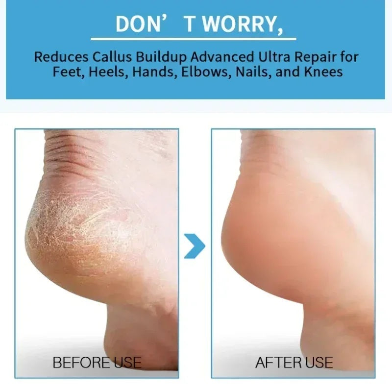 Foot Peeling Spray