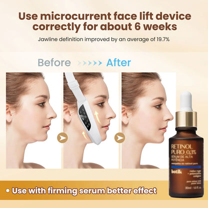 Electric V Face Lifting Beauty Device