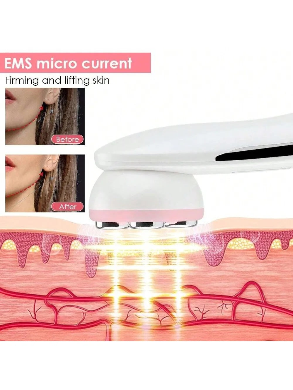 Professional Ultrasonic Skin Scrubber