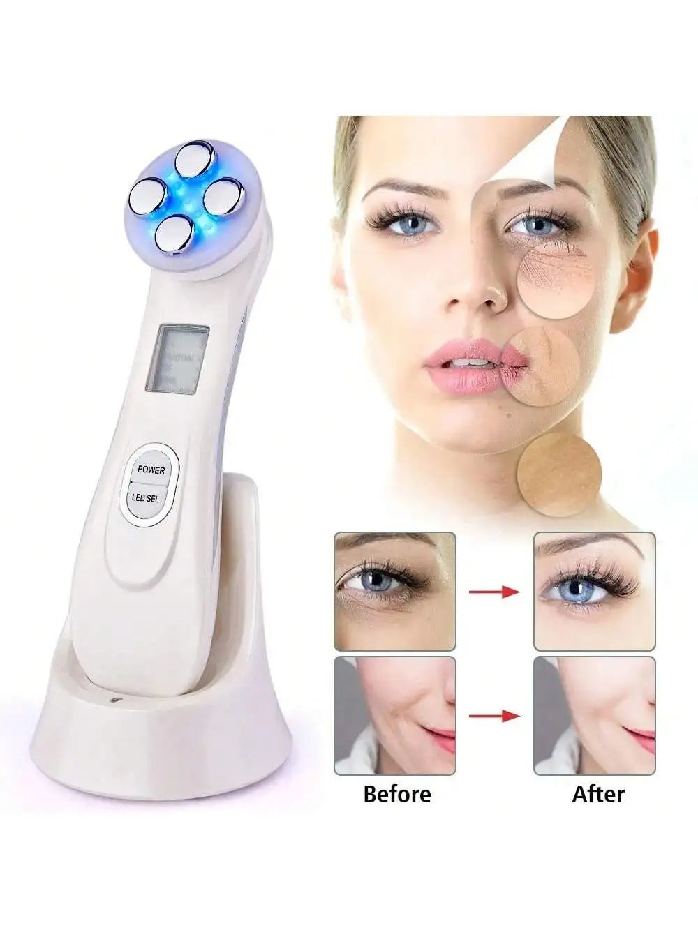 Professional Ultrasonic Skin Scrubber